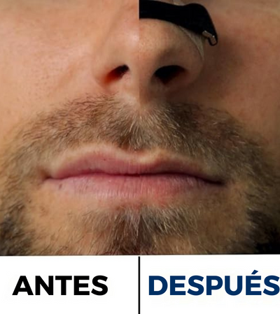 AirMax™ - Kit de tiras nasales magnéticas